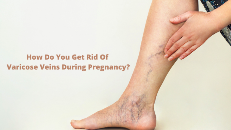 How To Get Rid Of Varicose Veins In Pregnancy Motherhood Hospitals Blog