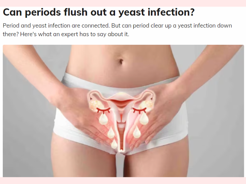 Yeast Infection After Your Period: Causes, Remedies, and Treatment