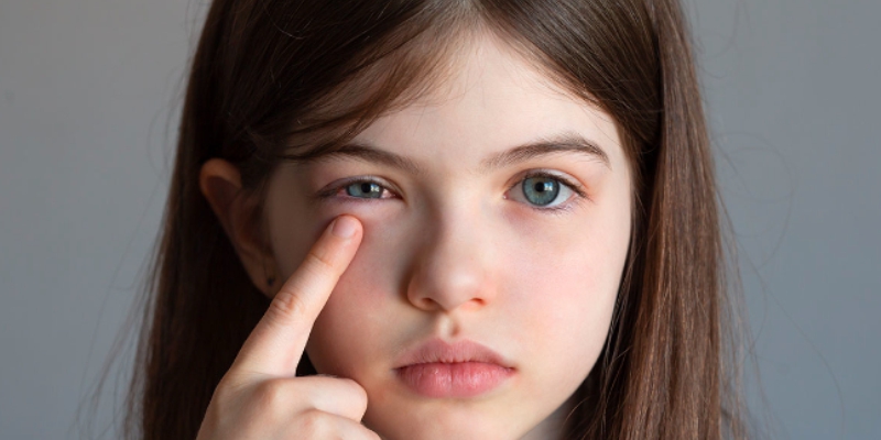 eye flu in children -How to protect