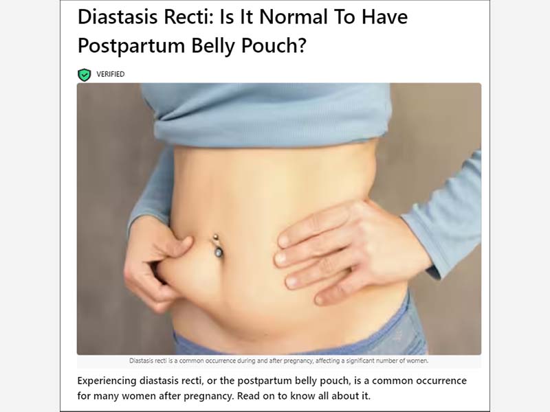 Diastasis Recti: Is It Normal To Have Postpartum Belly Pouch? - Motherhood  Hospitals India